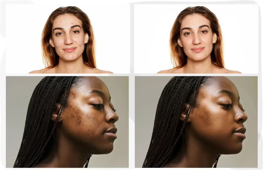 Face Retouch example